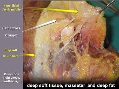 Courtesy Dr. Bryan Mendelson