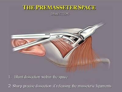 Courtesy Dr. Bryan Mendelson